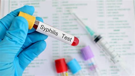 syfilis incubatietijd|Syfilis: Wat zijn de symptomen, stadia, blijvende。